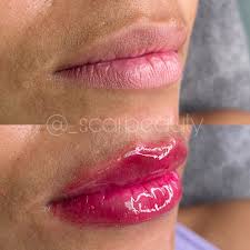 BB Lips