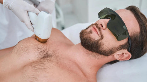 Depilación Laser Definitiva