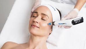 Dermapen (microneedling)